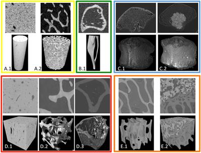 Precision of Digital Volume Correlation Approaches for Strain Analysis in Bone Imaged with Micro-Computed Tomography at Different Dimensional Levels